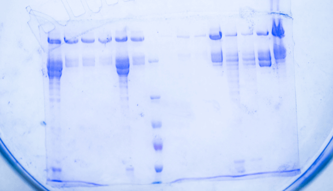 SDS-PAGEの仕組み：原理と成分の役割（電荷、分子量）